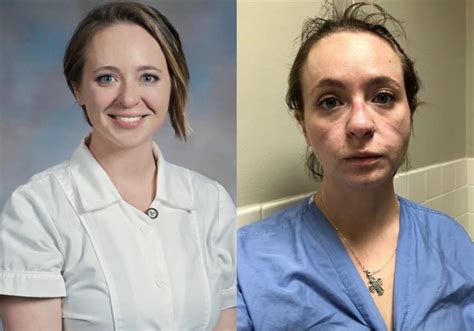 catherine ivy this nurse shows her photos of before and after nine months of pandemic