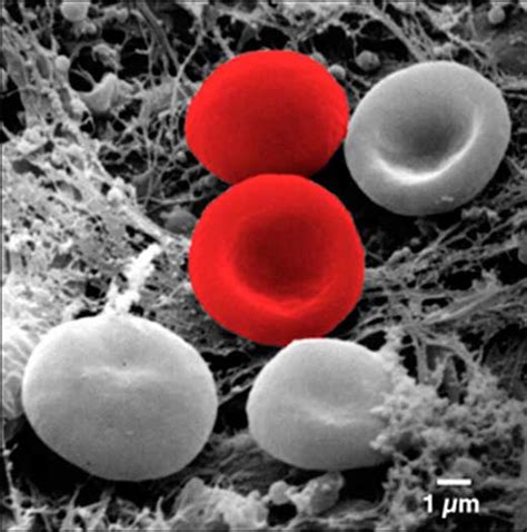 Color And 3d For Scanning Electron Microscopy Microscopy Today