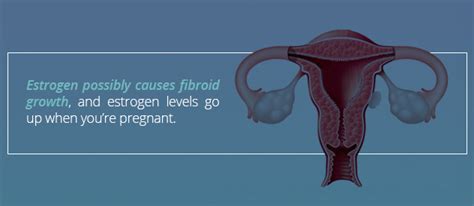 Tips On Getting Pregnant With Fibroids Usa Fibroid Centers