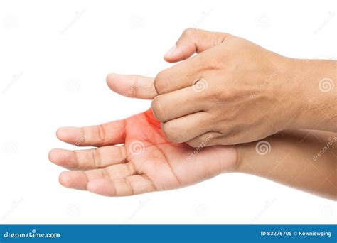 Man Scratch The Itch With Hand Stock Image Image Of Healthcare Hand