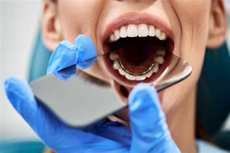 Can You Fix An Overbite With Lingual Braces Dental Health Clinic