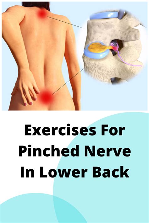 How To Relieve Pinched Nerve In Hip