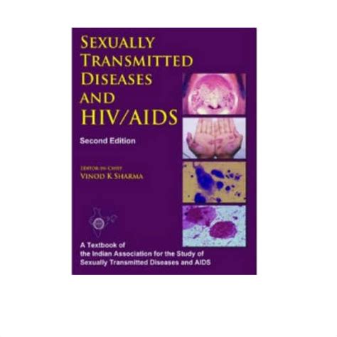 Sexually Transmitted Diseases And Hivaids By Vinod K Sharma Prithvi