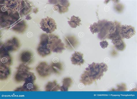 Fungirhizopus Bread Mold Under The Microscope Stock Photo Image Of