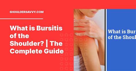 What Is Bursitis Of The Shoulder The Complete Guide Shoulder Savvy