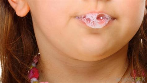 Young Girl With Saliva Ratemds Health News
