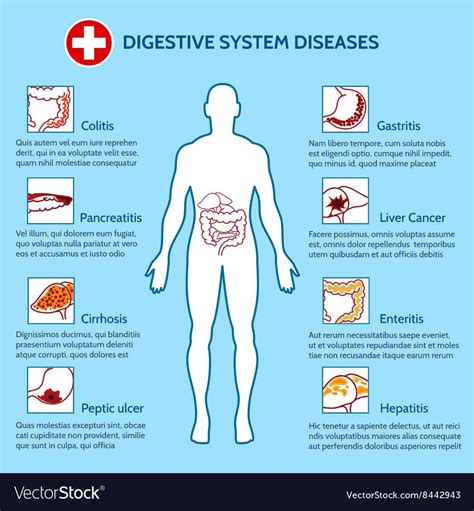Human Digestive System Diseases Vector Image On Vectorstock In 2022