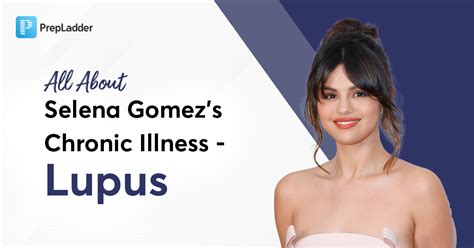 All About Selena Gomezs Chronic Illness Lupus