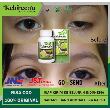 Jual Obat Kelopak Mata Turun Obat Mata Ptosis Mata Kecil Sebelah