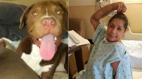 Yasmin Adam Florida Pit Bull Dog Attack Leaves Owner Left Arm Ripped Off