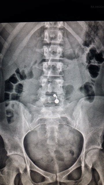Patil medical college & hospital pune. Pin on X-rays