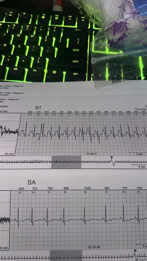 The first photo is my testing with a zio patch2 years ago. All the