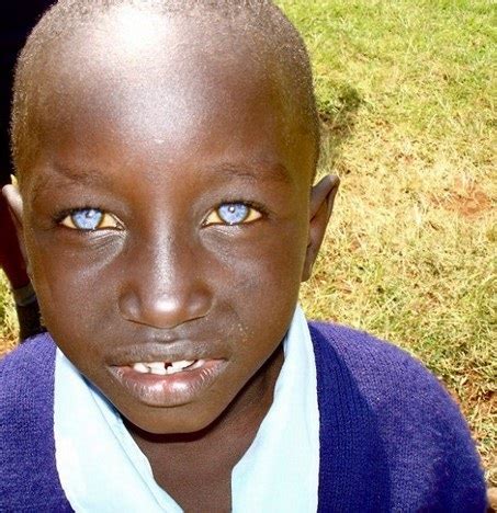 Black People Born With Blue Eyes