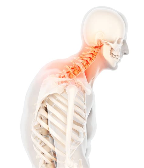 When To See A Chiropractor For Neck Pain And Shoulder Pain