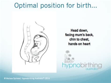 Do You Have A Baby In The Breech Or Posterior Position Hypnobirthing