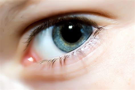 Eyelid Twitching: Causes, Treatment, and Prevention