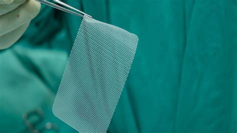 Hernia Mesh How A Patch Can Torment Your Body After Surgery Safety Watch