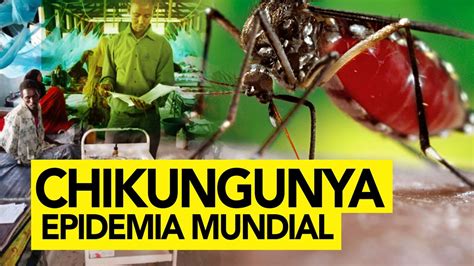 Chikungunya Definición Síntomas Y Tratamiento Natural Youtube