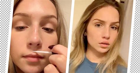 Tiktok Teens Are Glueing Their Upper Lips In New Challenge