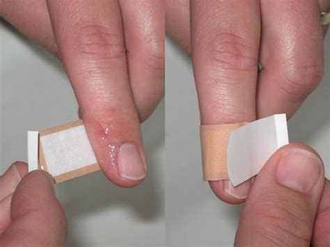 First Aid 101 How To Treat Cut Fingers