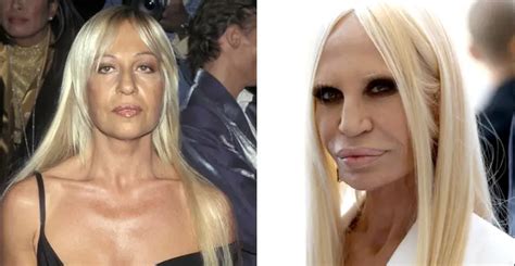 Craziest Plastic Surgeries You Have To See To Believe Page Of Slapped Ham