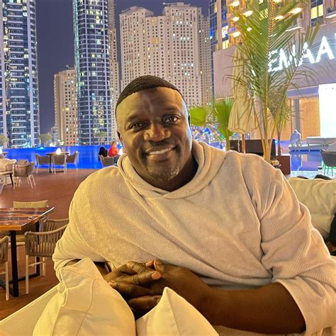 akon spends 7500 on his new hair transplant