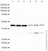 Pictures of How To Use Loading Control In Western Blot