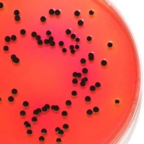 Most cases of salmonellosis are mild; XLD Agar - Lab M