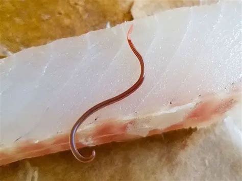 What Do Worms In Tuna Look Like Warning Disturbing Images Inside