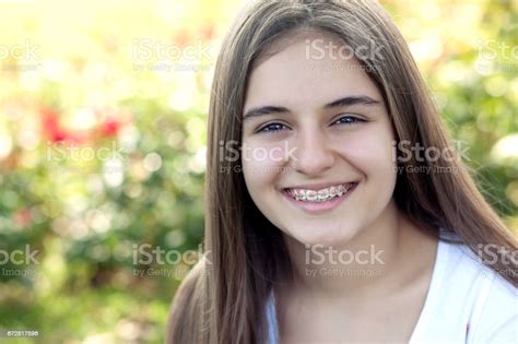 Pretty Teenage Girl Wearing Braces Smiling Cheerfully Stock Fotografie