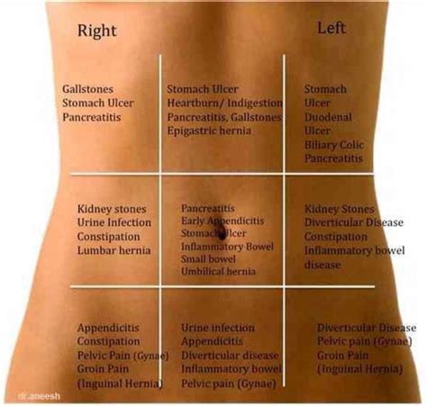 Abdominal Pain Chart Get To Know Your Tummy Pains Trusper