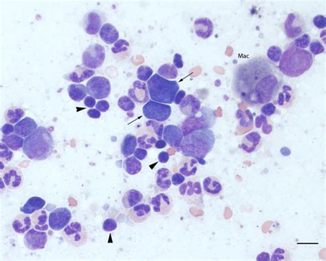 Cytology Of Bone Marrow Aspirate Showing An Elevated Myeloiderythroid