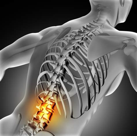 Lower Back And Spine Pain Causes And Treatment In Edison New