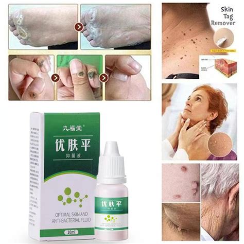 3 Boxes Removal Serum Warts And Skin Tags Remover Warts Remover