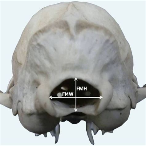 Outlines Of The Caudal View Of The Skull Showing Foramen Magnum Height