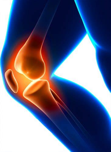 What Is Adolescent Anterior Knee Pain