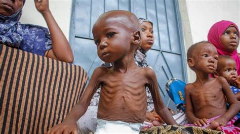 10 Million Children Face Starvation In Horn Of Africa Unicef Peoples
