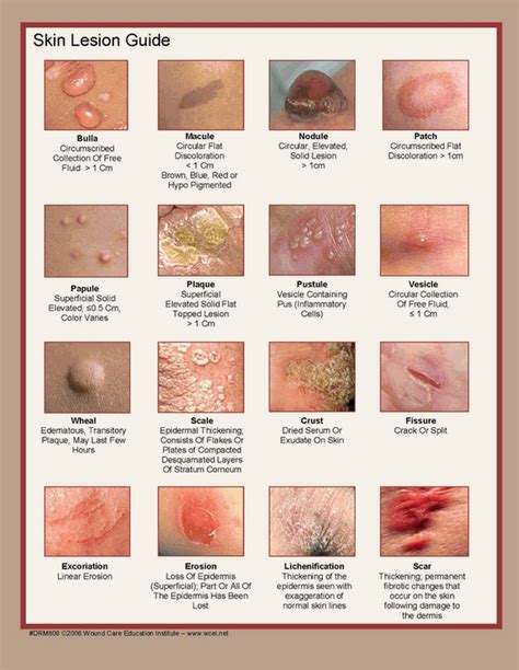 Skin Lesion Guide Faculty Of Medicine