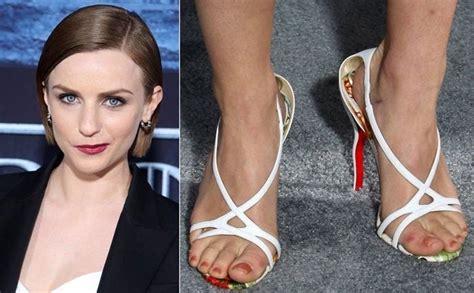 26 Celebs With Ugly Feet Gross Calli And Crusty Hammer Toes Peaceful