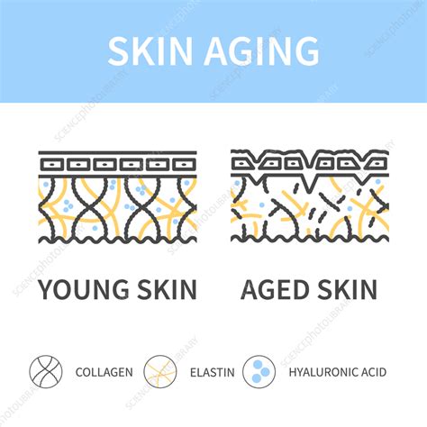 Skin Aging Conceptual Illustration Stock Image F0414552 Science