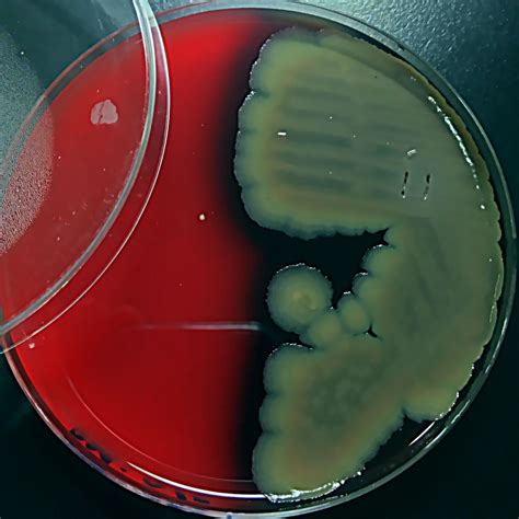 Colonies Of Bacillus Cereus On Blood Agar Evident Of Large Colonies
