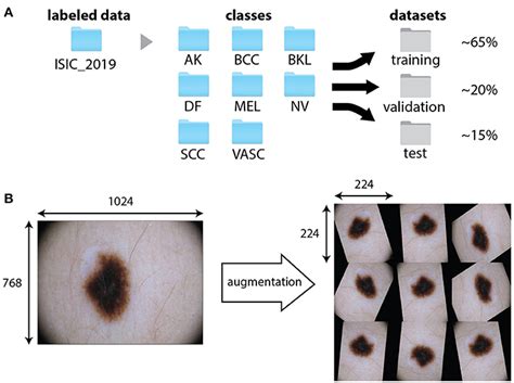 Frontiers Convolutional Neural Network For Skin Lesion Classification