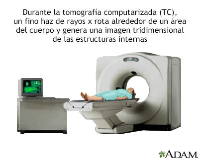 Spanish HIE Multimedia Angiotomografía computarizada abdomen y pelvis