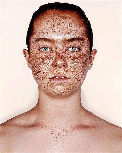Unique Beauty Of Freckled People Documented By Brock Elbank Freckles Freckle Face Portrait