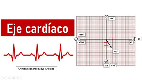 🔴 Electrocardiograma ¿cómo Calcular El Eje Cardíaco Youtube
