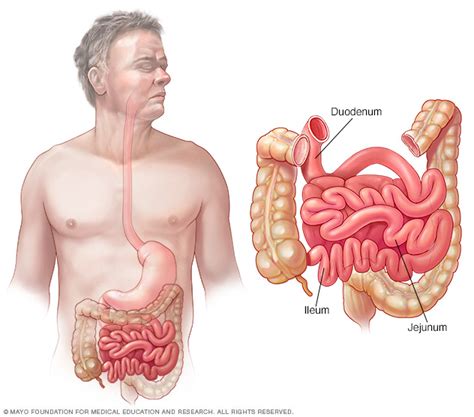 Which of the following organs is where most nutrients are absorbed large intestine *** esophagus small intestine stomach 2. Capsule endoscopy - Drugs.com