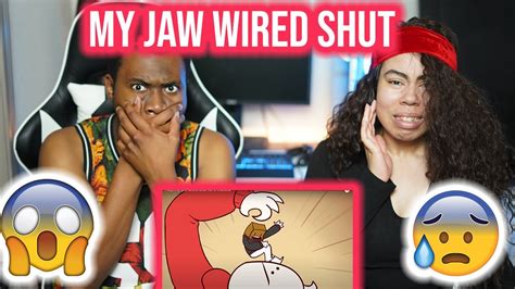 Somethingelseyt I Had My Jaw Wired Shut For 2 Months Reaction