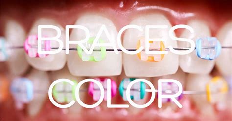 Braces Band Colors Adding Style To Orthodontic Journey