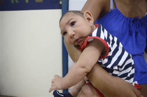 Zika Virus Health Officials Confirm Link With Birth Defects World