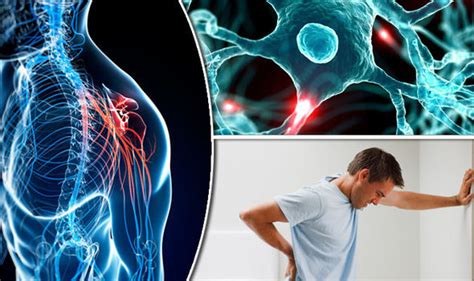 An autopsy case of the marburg variant of multiple sclerosis (acute multiple sclerosis) diagnostic criteria for multiple sclerosis: Multiple sclerosis symptoms - consitipation and fatigue ...